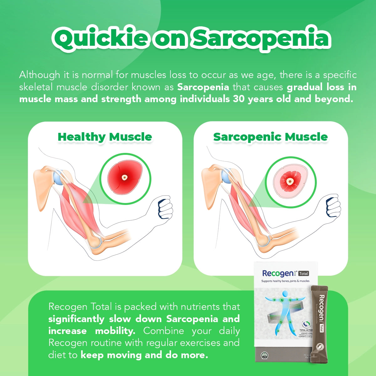 NCI Recogen helps with joint cartilage, while Bone K+® supports bone health. Order via 6744 5566 now!